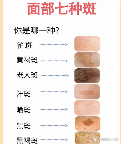 这是什么斑