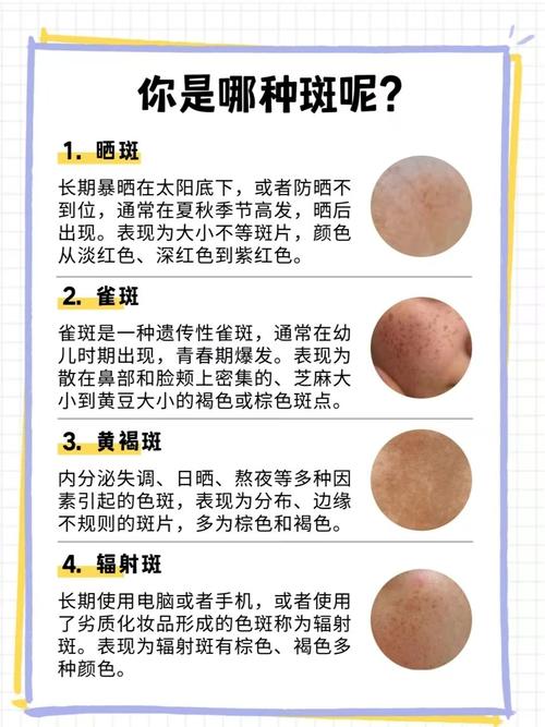 这是什么斑
