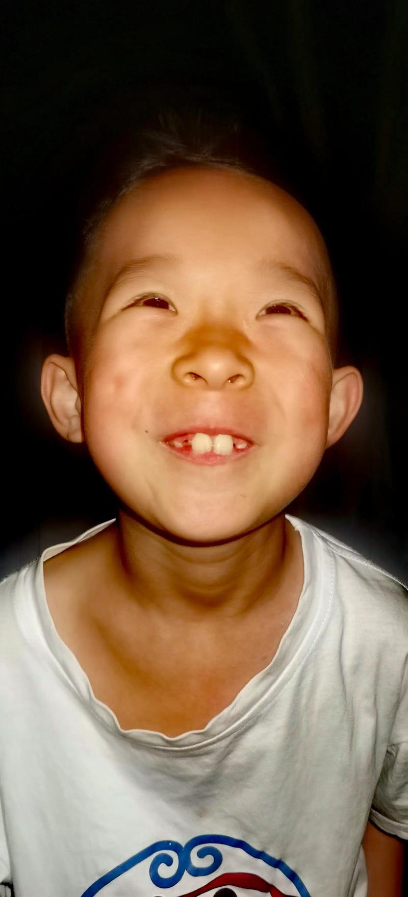 板牙是什么牙齿