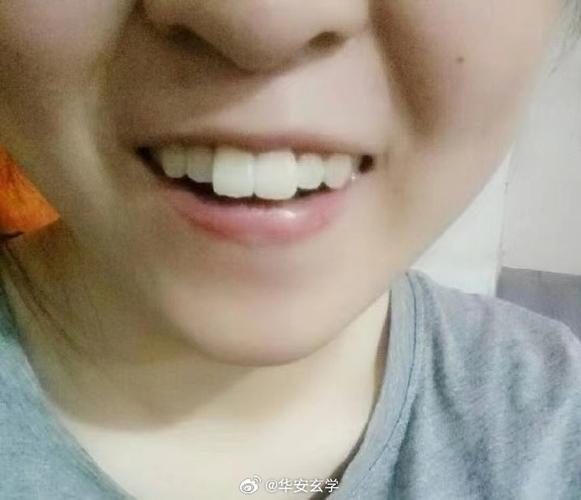 板牙是什么牙齿
