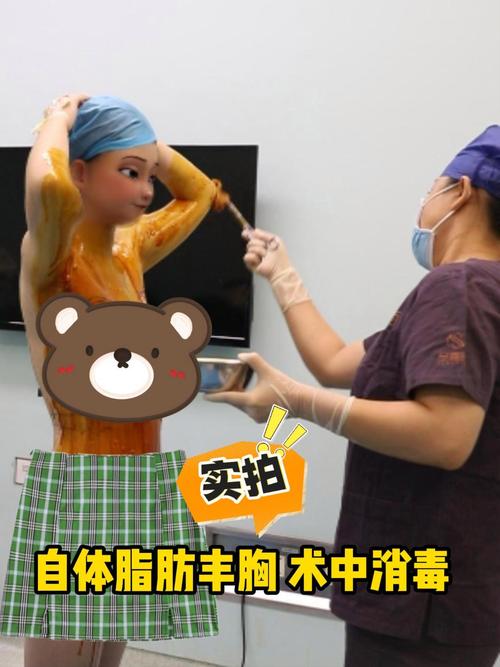 什么是丰胸手术