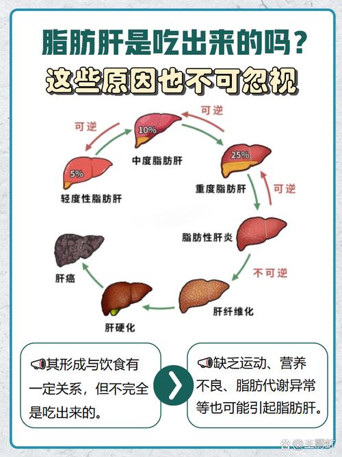 脂肪肝的原因是什么