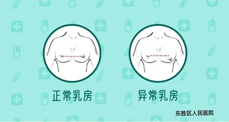 正常的乳房是什么样的