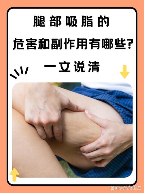 吸脂减肥有什么副作用吗