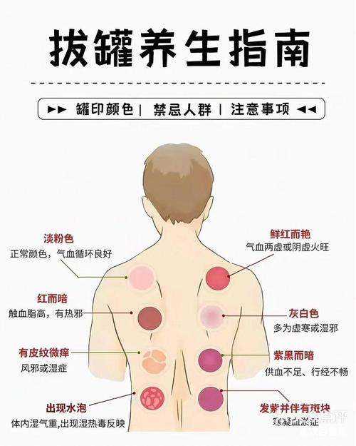 腋下减肥拔罐八什么穴位