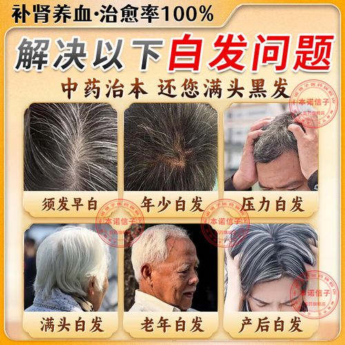 头发变白吃什么好