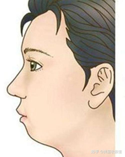 什么是小下巴