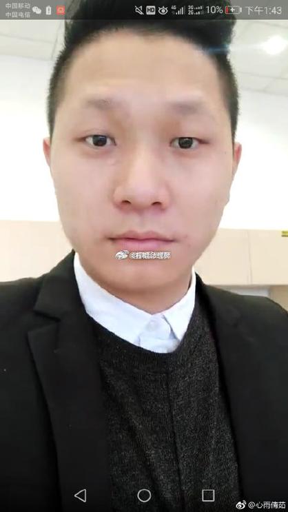 什么是短眉