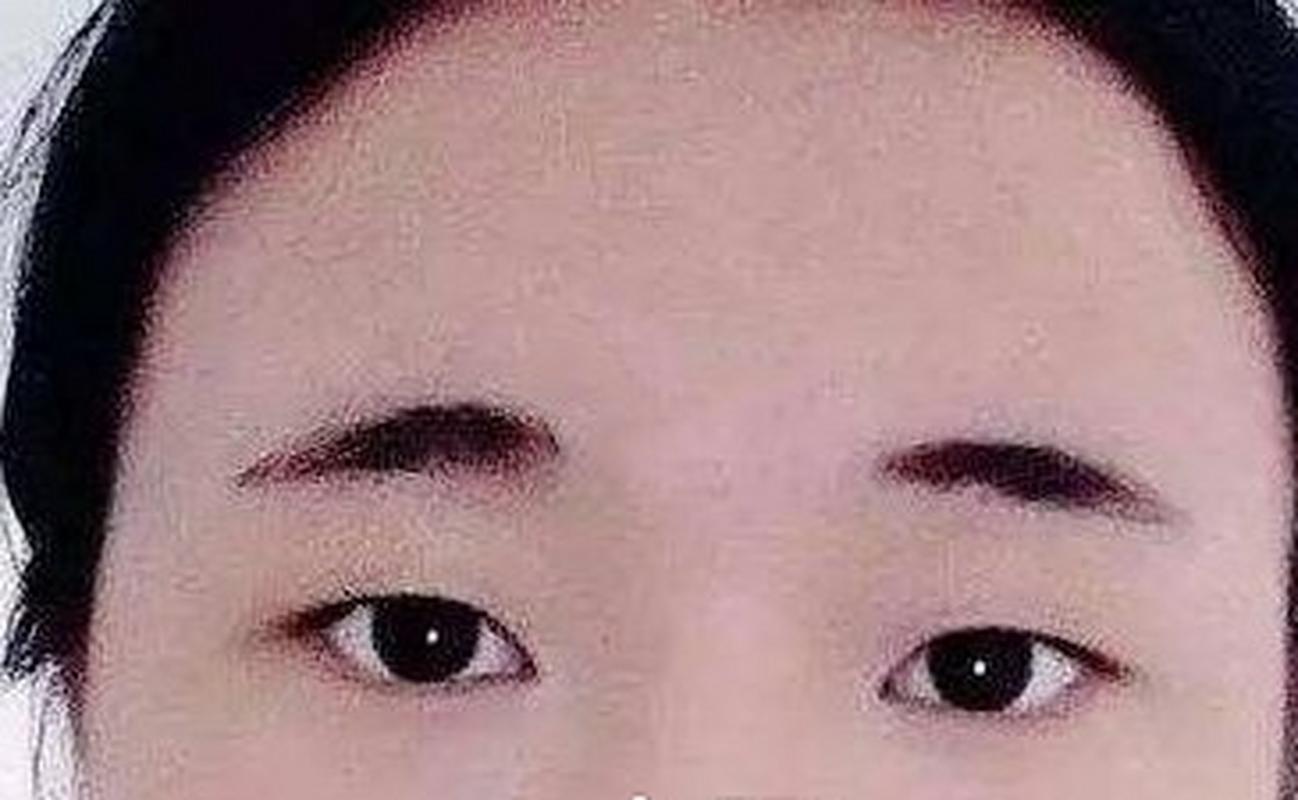 什么是短眉