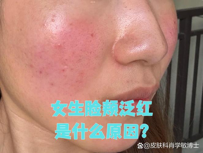 什么面颊