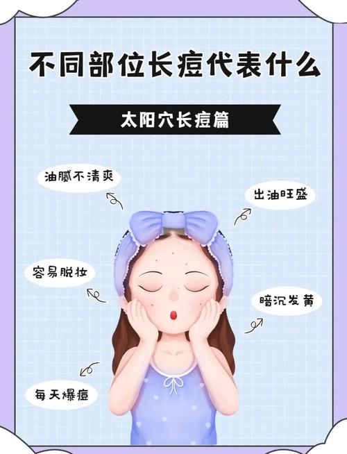 为什么太阳穴长痘痘
