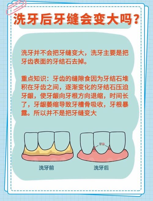 什么情况需要洗牙