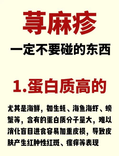 荨麻疹忌吃什么