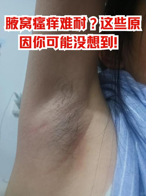 腋下是什么地方