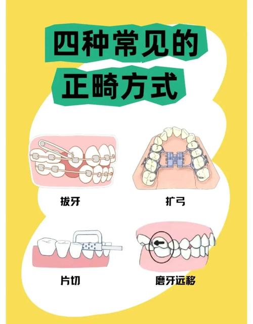 牙齿矫正有什么方法
