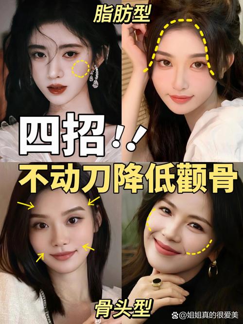 颧骨高是什么原因