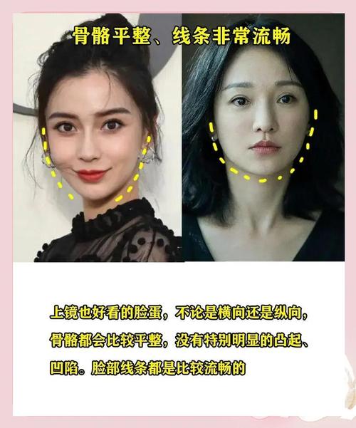 颧骨高是什么原因