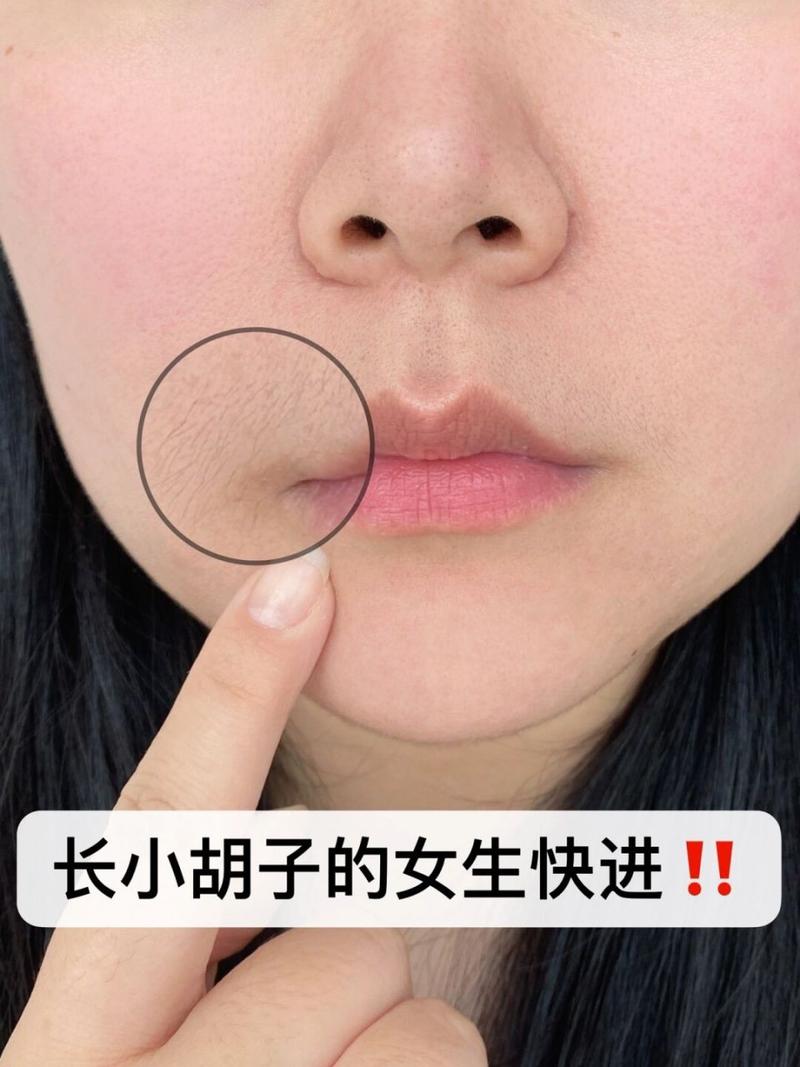 为什么女的长胡子