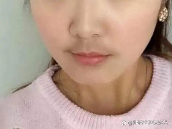 为什么女的长胡子
