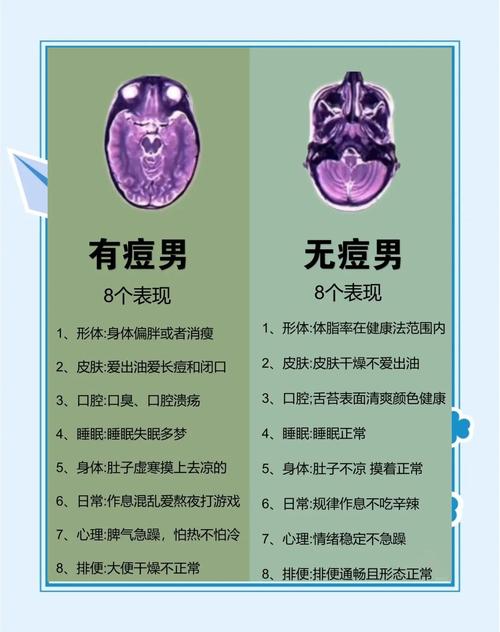 男生为什么会长痘