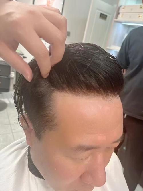 发际线高什么意思
