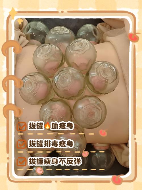 拔罐减肥什么原理