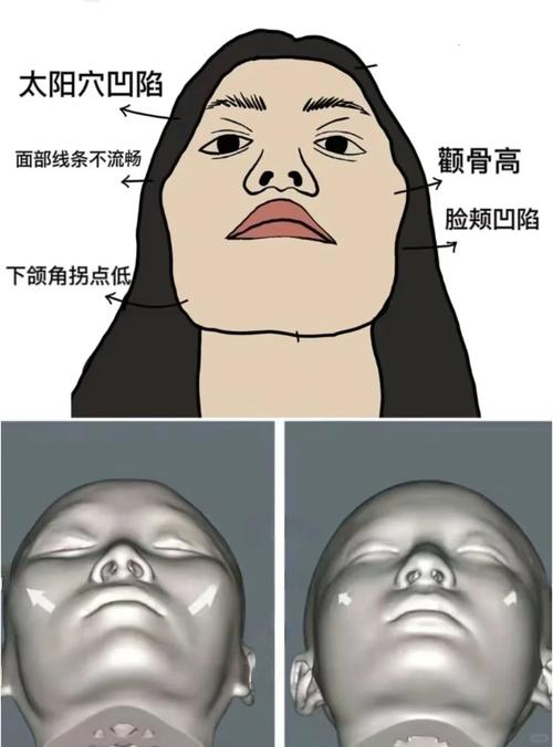 什么叫颧骨高