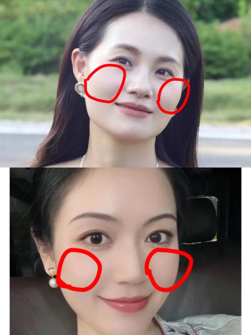 什么叫颧骨高