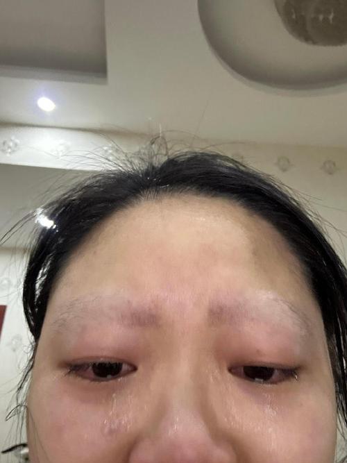 眉毛掉了是什么原因