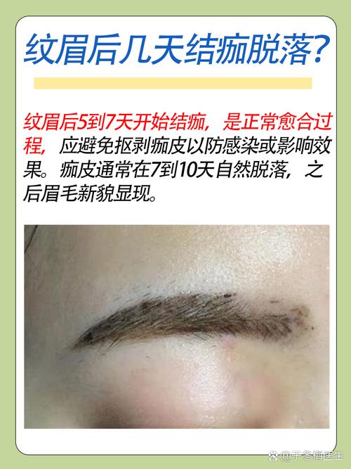 眉毛掉了是什么原因