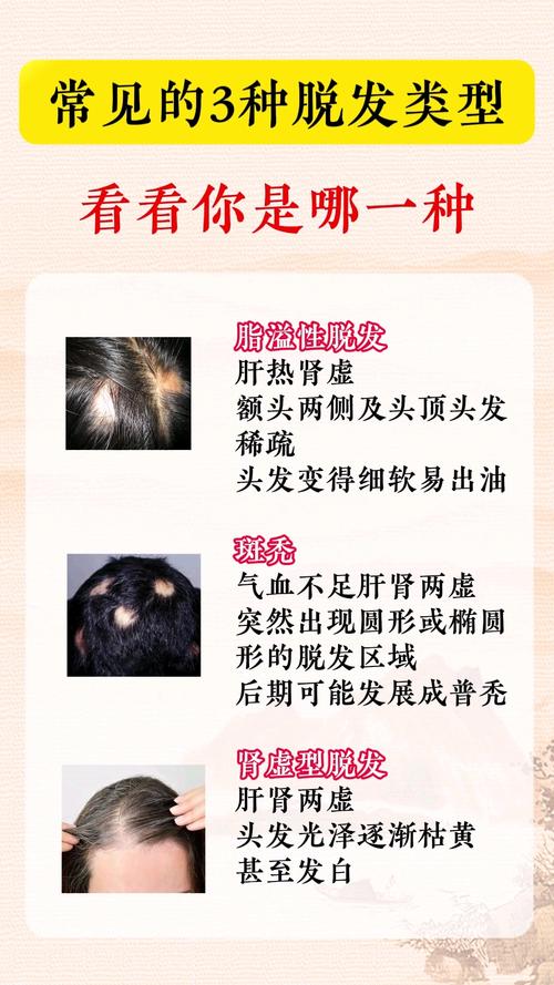 掉头发和什么有关