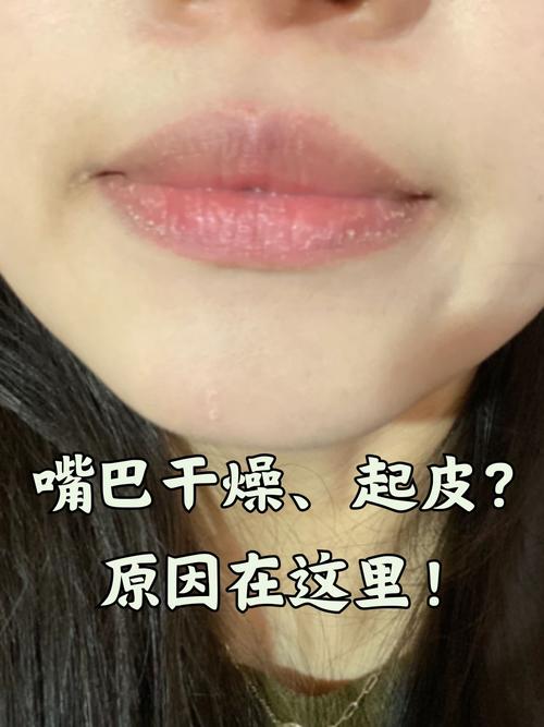 嘴巴干涩是什么原因