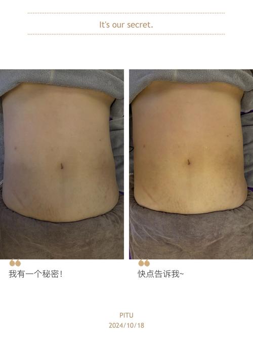 腹部减肥成什么样儿好
