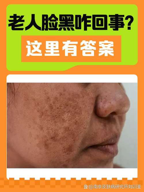 脸黑是为什么