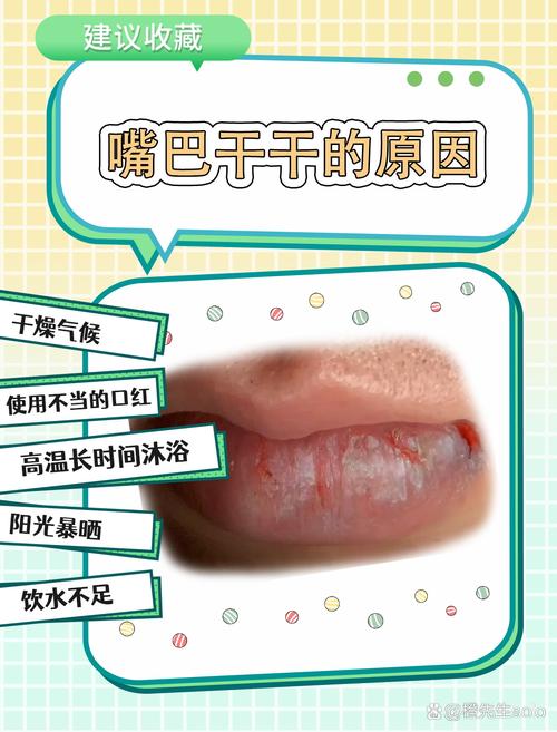 为什么唇干
