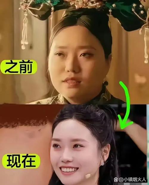 什么脸型减肥是潜力股