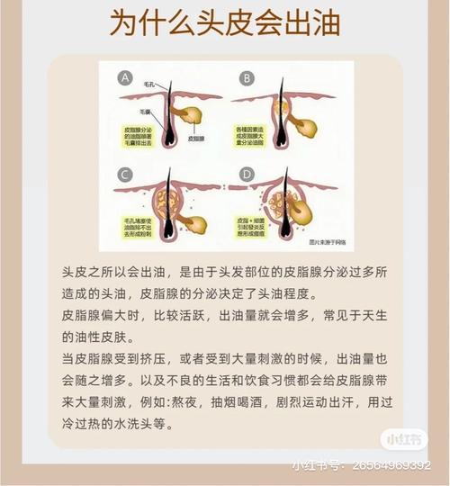 额头出油是什么原因