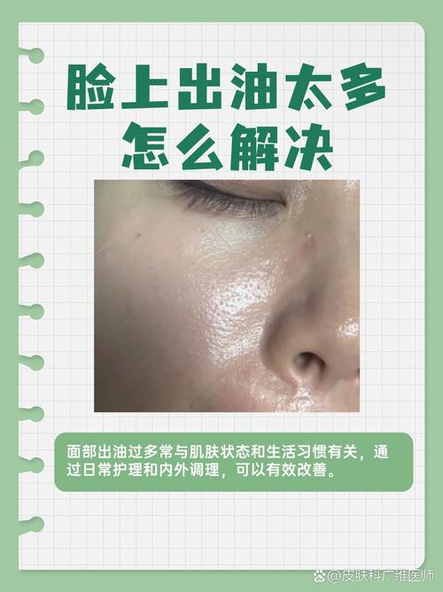 额头出油是什么原因