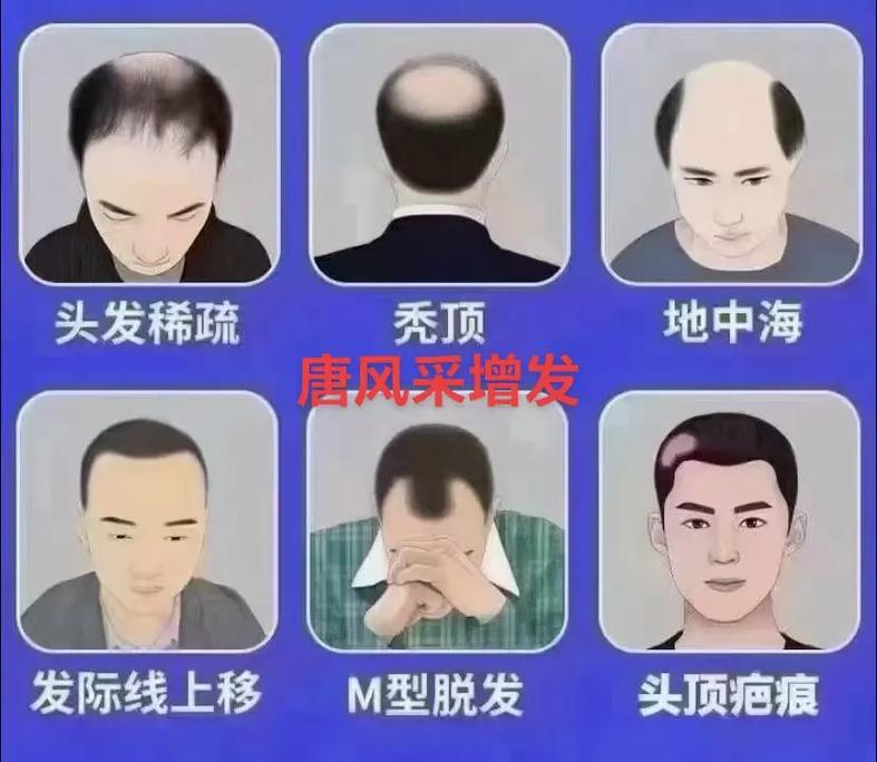 头发变少是什么原因