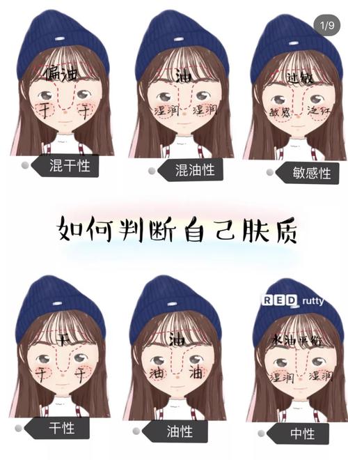 混合性皮肤是什么