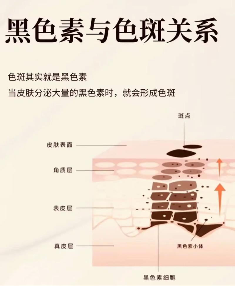 黑色素是什么图片