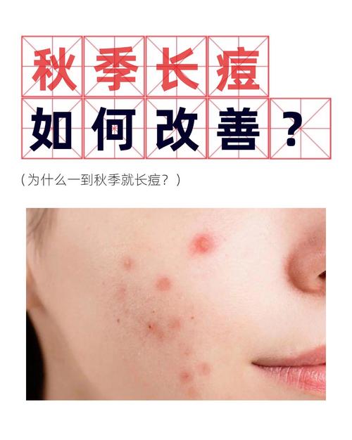 秋天为什么长痘痘