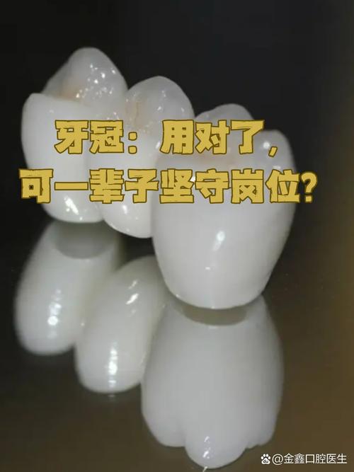 什么是做牙冠