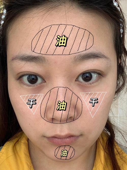 t区油两颊干是什么肤质