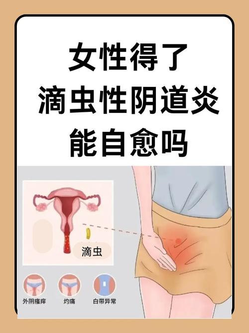 妇科病是什么样的