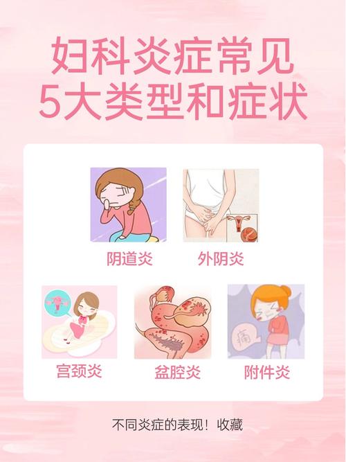 妇科病是什么样的
