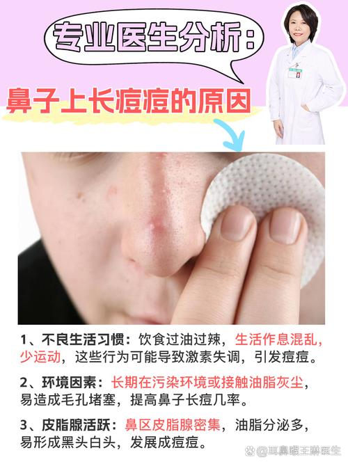 鼻头长痘是什么原因