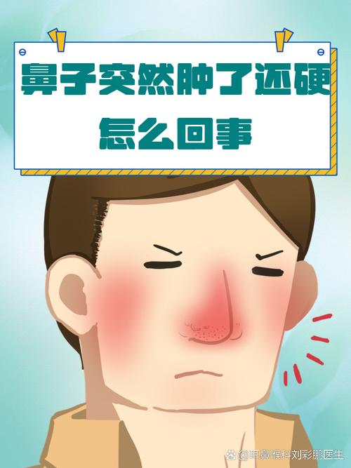 鼻子肿痛是什么原因