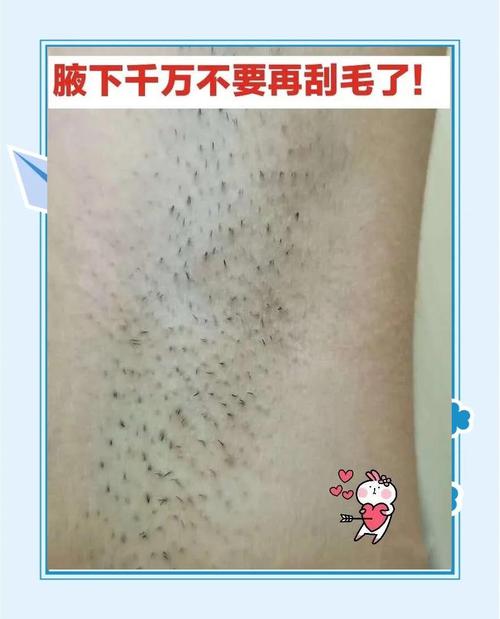 毛为什么越刮越多