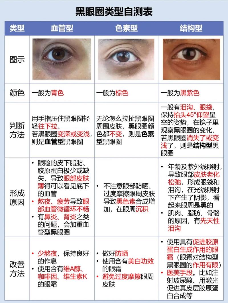 眼眶黑是什么原因